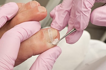 Podiatrist examining an ingrown toenail at Arcadia Foot and Ankle in Scottsdale, AZ
