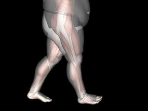 Obesity and Orthotics