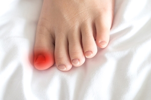 Infected Ingrown Toenails